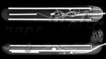 TripleShot_рентген.jpg TripleShot_рентген.jpg